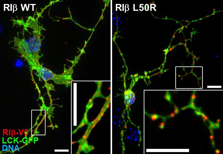 RIb puncta in HC neurons